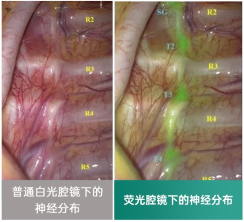 泰康仙林鼓楼医院手汗症门诊年度总结：关注患者需求，提升治疗效果